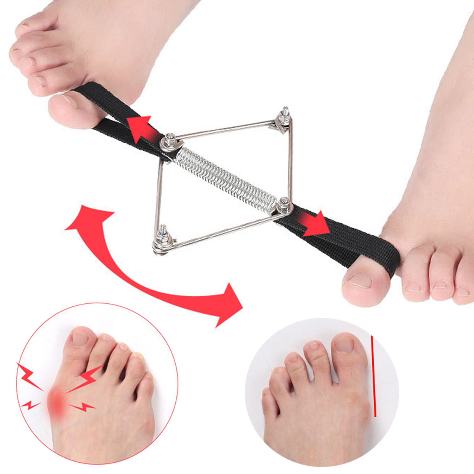 Pilates Yoga Wellness - Correcteur d'oignon en nylon et acier,